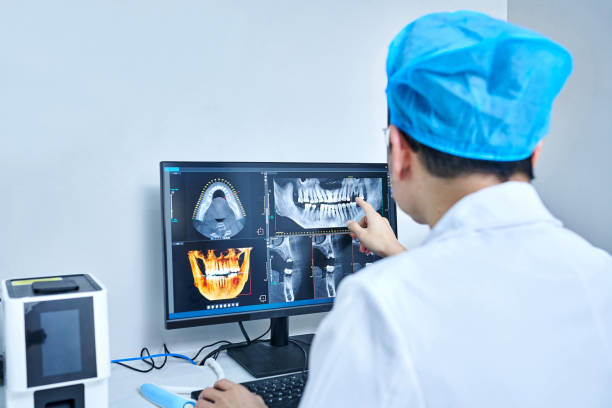 Best Emergency Root Canal Treatment in Dianapolis, IN